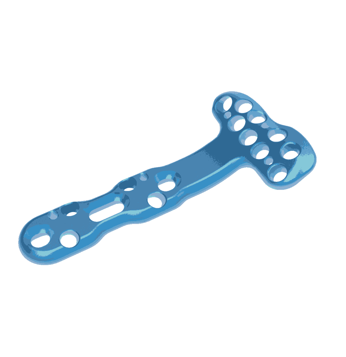 Volar Distal Radius Locking Compression Plate -14